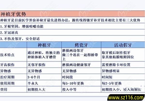 烤瓷牙价目表种植牙 烤瓷牙有多贵