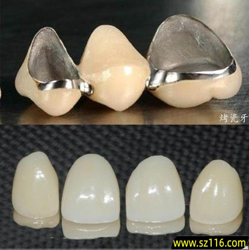 烤瓷牙会伤害牙齿吗？烤瓷牙安上对真牙会有伤害吗