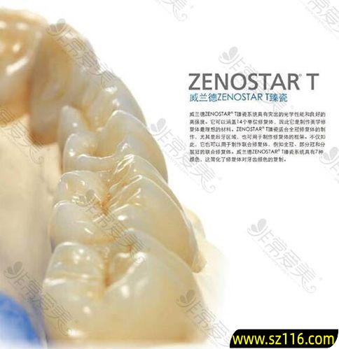 烤瓷牙美国瓷德国瓷，德国臻瓷全瓷牙怎么样