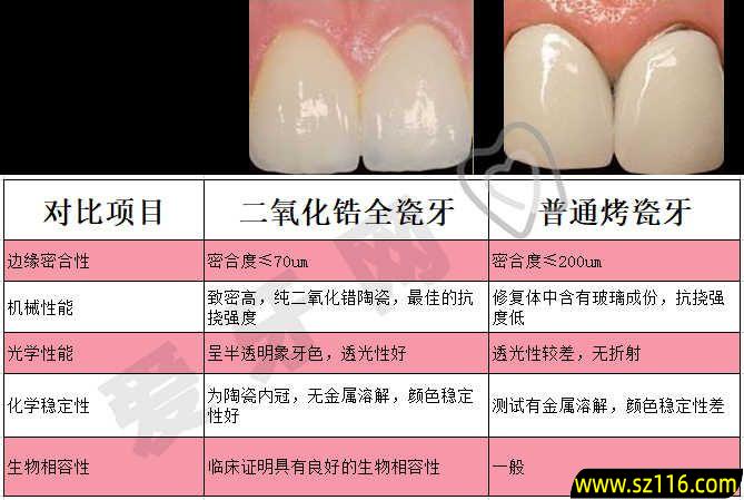 烤瓷牙和牙体镶嵌(全瓷冠牙体预备和烤瓷冠牙体预备的区别)