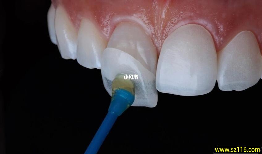 牙齿装烤瓷牙松？烤瓷牙冠松了怎么办